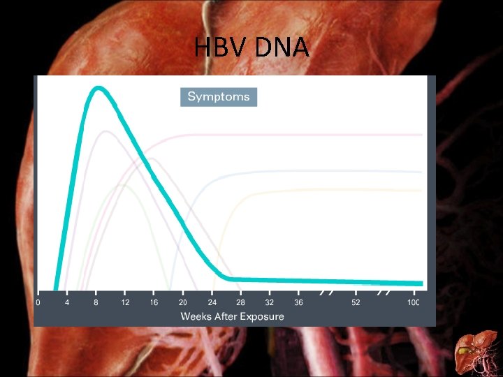 HBV DNA 