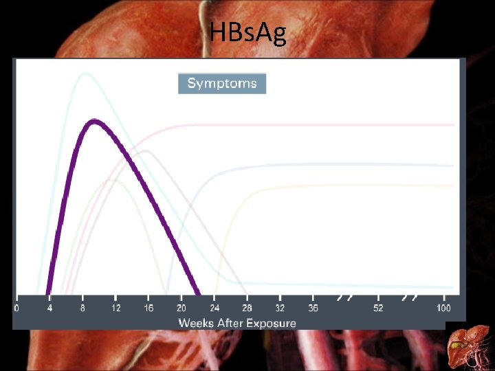 HBs. Ag 