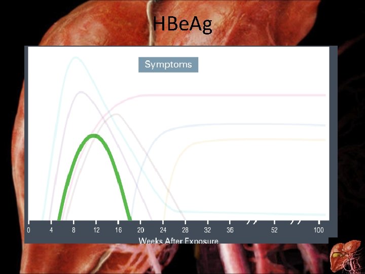 HBe. Ag 