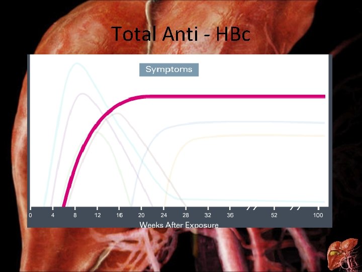Total Anti - HBc 