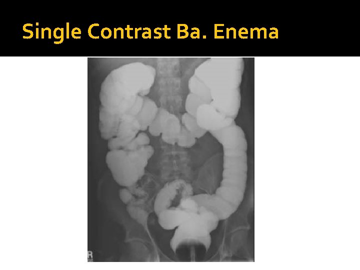 Single Contrast Ba. Enema 