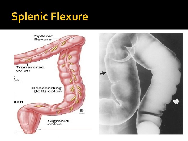 Splenic Flexure 