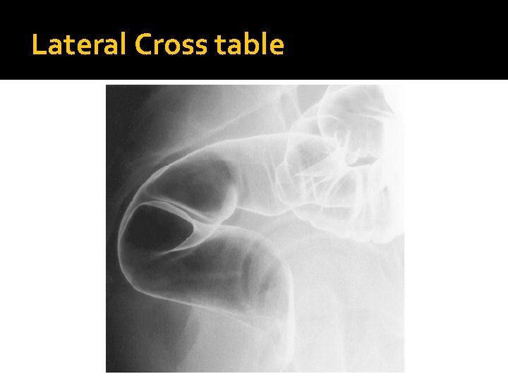 Lateral Cross table 