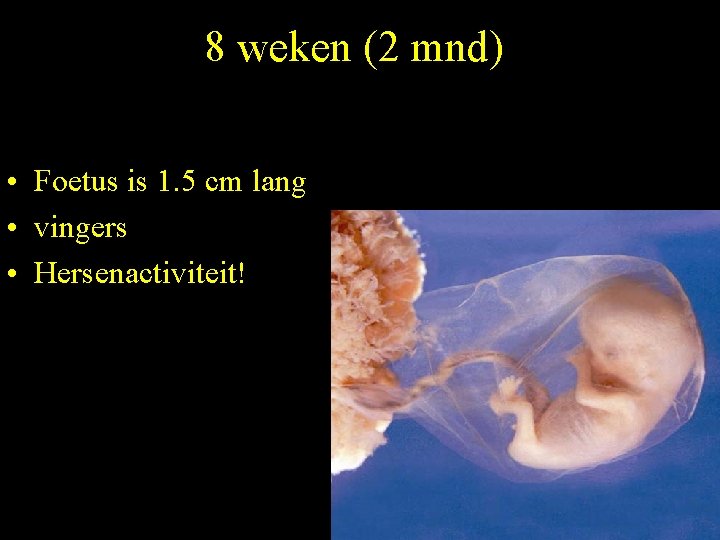 8 weken (2 mnd) • Foetus is 1. 5 cm lang • vingers •