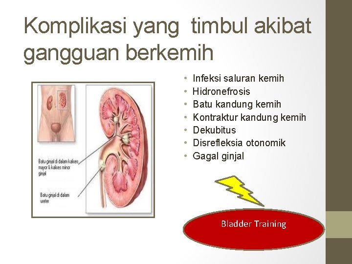 Komplikasi yang timbul akibat gangguan berkemih • • Infeksi saluran kemih Hidronefrosis Batu kandung