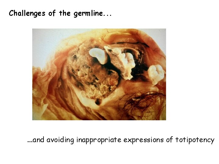 Challenges of the germline. . . and avoiding inappropriate expressions of totipotency 