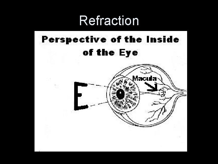 Refraction • Illustration of perspective with e on macula 