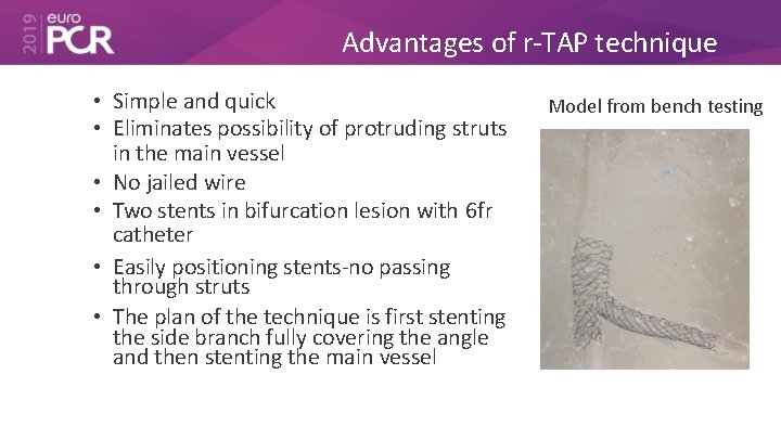 Advantages of r-TAP technique • Simple and quick • Eliminates possibility of protruding struts