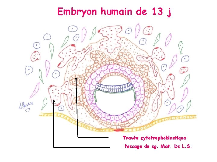 Embryon humain de 13 j Travée cytotrophoblastique Passage du sg. Mat. Ds L. S.