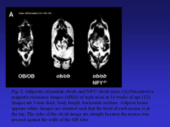 Science 1996 December 6; 274: 1704 -1707. Fig. 2. Adiposity of normal, ob/ob, and