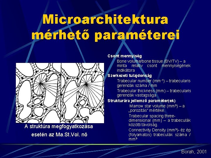 Microarchitektura mérhető paraméterei A struktúra megfogyatkozása esetén az Ma. St. Vol. nő Csont mennyiség