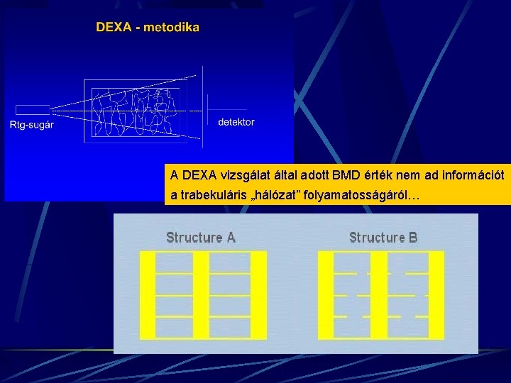 A DEXA vizsgálat által adott BMD érték nem ad információt a trabekuláris „hálózat” folyamatosságáról…