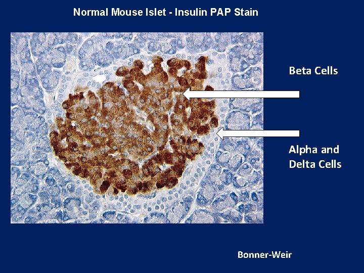 Normal Mouse Islet - Insulin PAP Stain Beta Cells Alpha and Delta Cells Bonner-Weir