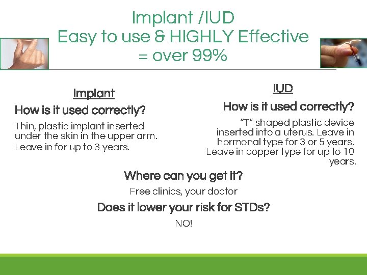 Implant /IUD Easy to use & HIGHLY Effective = over 99% IUD How is