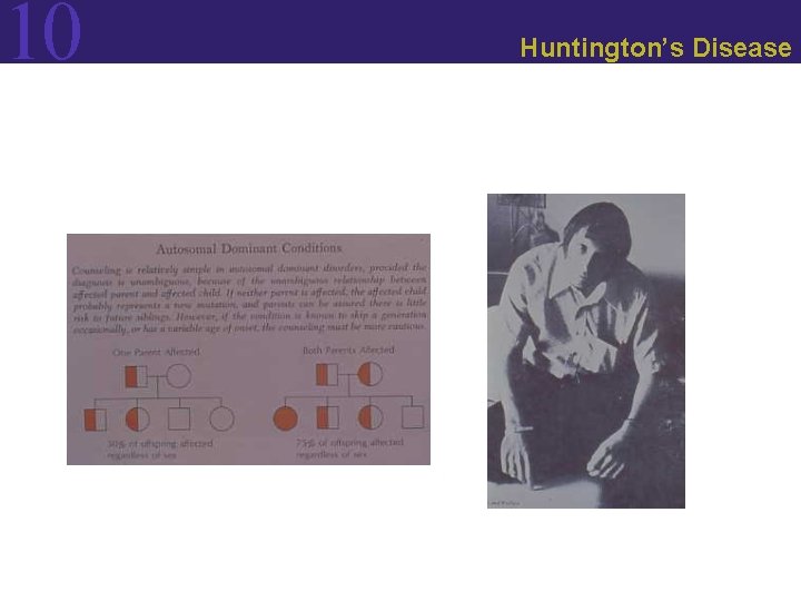 10 Huntington’s Disease 10 Huntington’s Disease