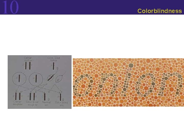 10 Colorblindness 10 Colorblindness