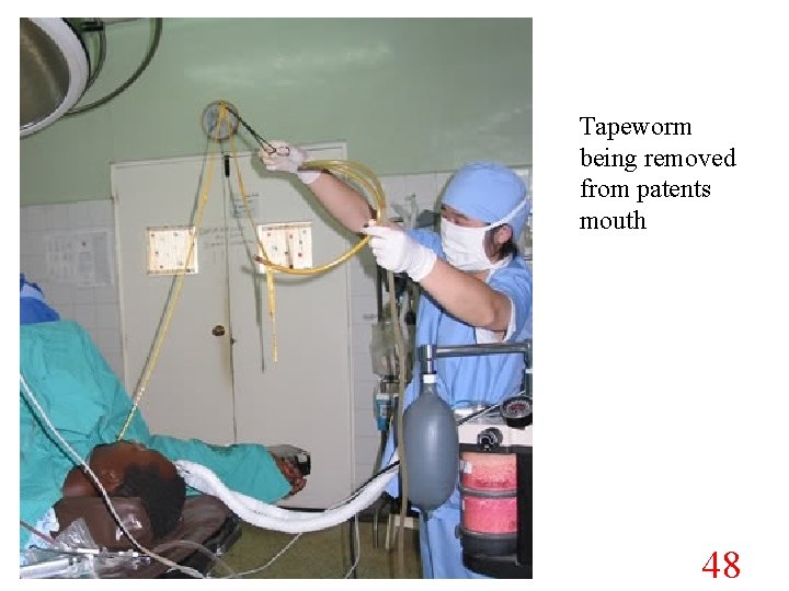 Tapeworm being removed from patents mouth 48 
