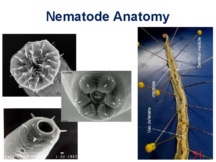 Nematode Anatomy 51 