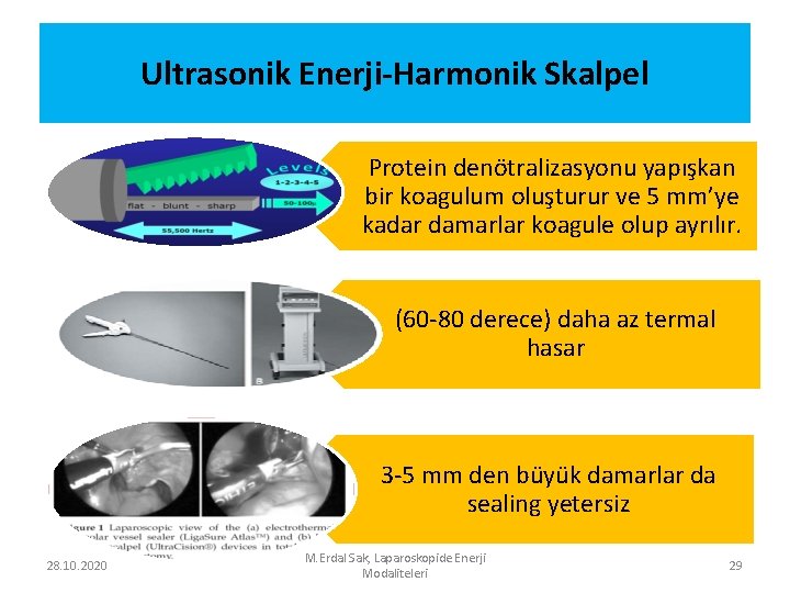 Ultrasonik Enerji-Harmonik Skalpel Protein denötralizasyonu yapışkan bir koagulum oluşturur ve 5 mm’ye kadar damarlar