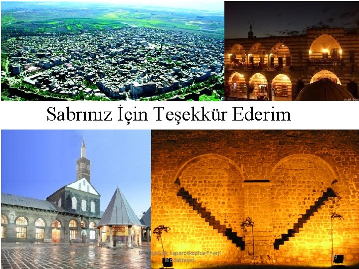 Sabrınız İçin Teşekkür Ederim 28. 10. 2020 M. Erdal Sak, Laparoskopide Enerji Modaliteleri 43