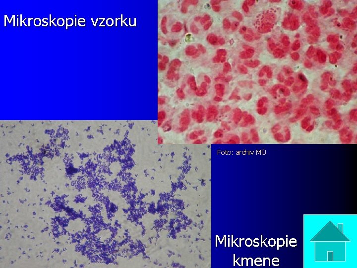 Mikroskopie vzorku Foto: archiv MÚ Mikroskopie kmene 