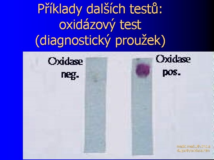 Příklady dalších testů: oxidázový test (diagnostický proužek) medic. med. uth. tmc. e du/path/oxidase. htm