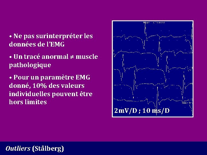  • Ne pas surinterpréter les données de l’EMG • Un tracé anormal muscle