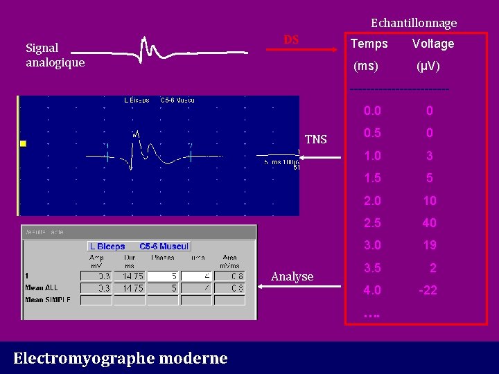 Echantillonnage Signal analogique DS Temps (ms) Voltage (µV) ------------ TNS Analyse 0. 0 0