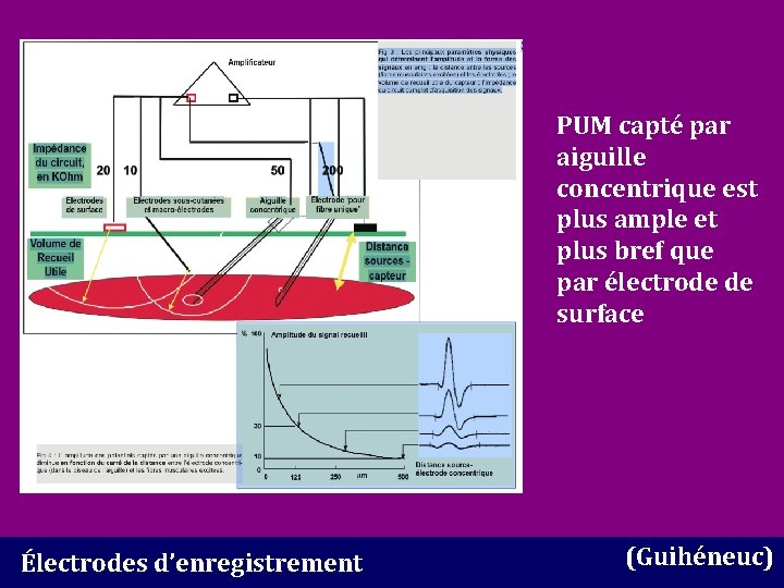 PUM capté par aiguille concentrique est plus ample et plus bref que par électrode