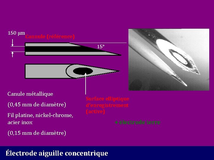 150 µm Cannule (référence) 15° Canule métallique (0, 45 mm de diamètre) Fil platine,