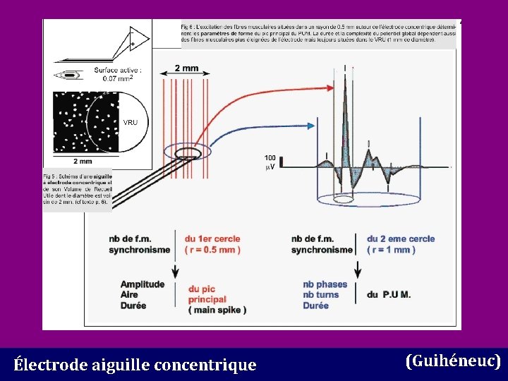 Électrode aiguille concentrique (Guihéneuc) 