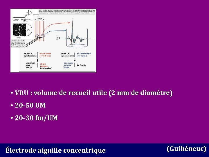  • VRU : volume de recueil utile (2 mm de diamètre) • 20