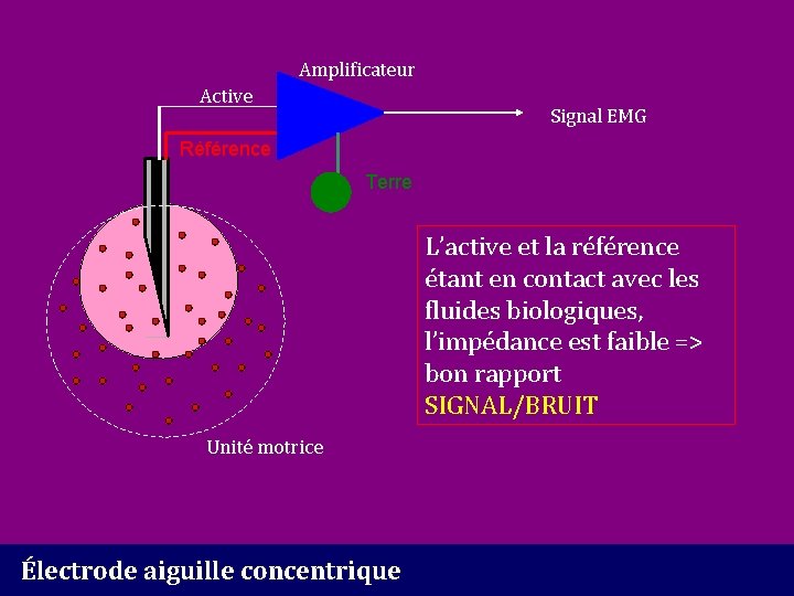 Amplificateur Active Signal EMG Référence Terre L’active et la référence étant en contact avec