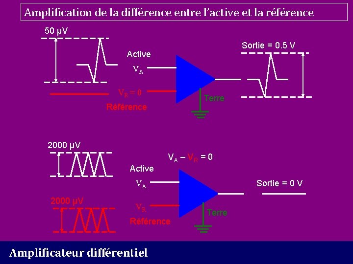 Amplification de la différence entre l’active et la référence 50 µV Sortie = 0.