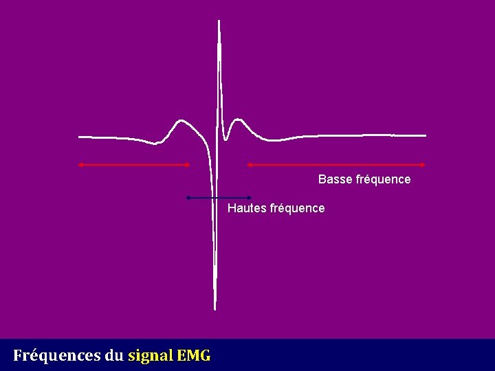 Basse fréquence Hautes fréquence Fréquences du signal EMG 