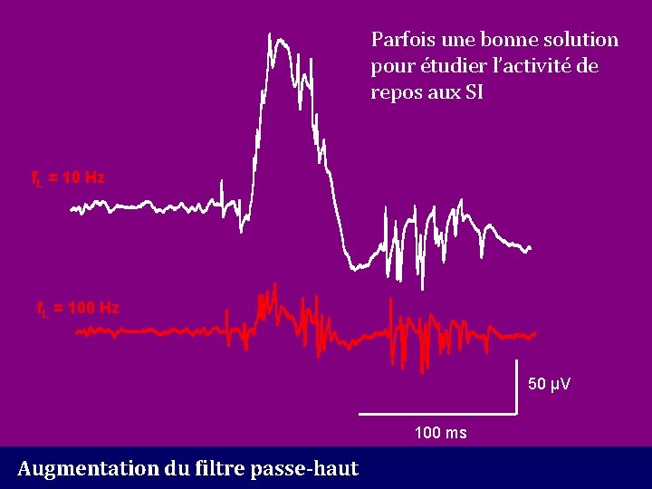 Parfois une bonne solution pour étudier l’activité de repos aux SI f. L =