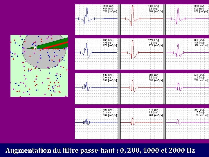 Augmentation du filtre passe-haut : 0, 200, 1000 et 2000 Hz 