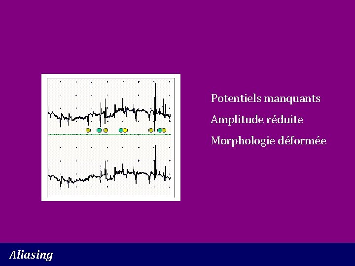 Potentiels manquants Amplitude réduite Morphologie déformée Aliasing 