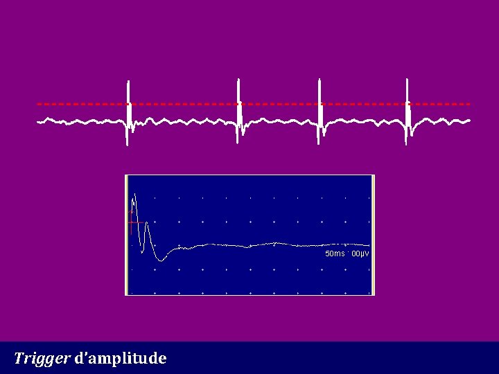 Trigger d’amplitude 