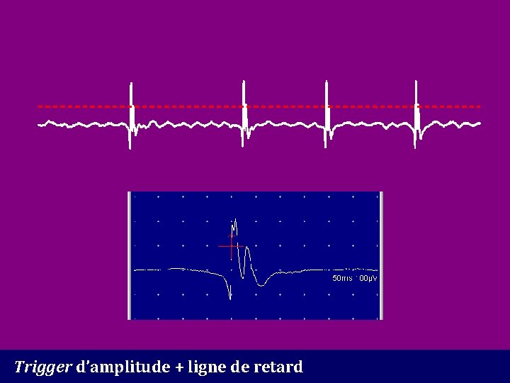 Trigger d’amplitude + ligne de retard 