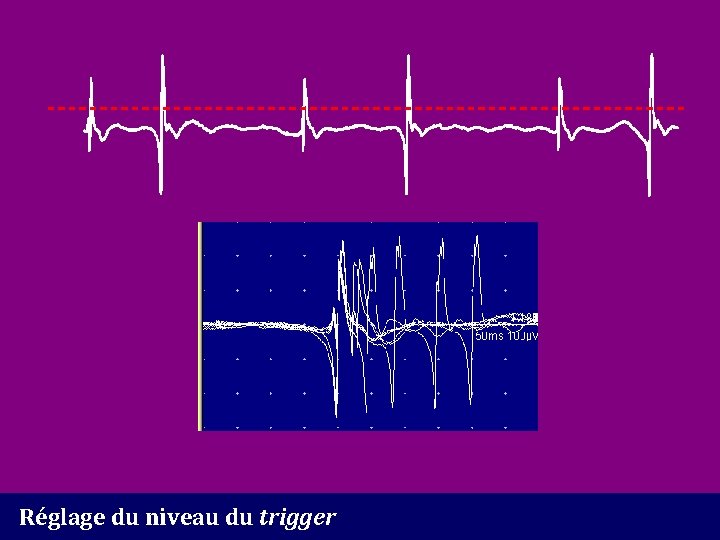 Réglage du niveau du trigger 
