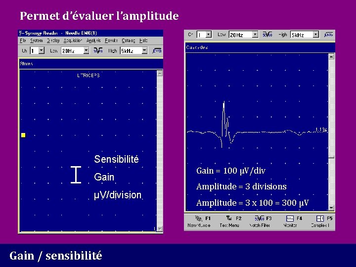 Permet d’évaluer l’amplitude Sensibilité Gain µV/division Gain / sensibilité Gain = 100 µV/div Amplitude