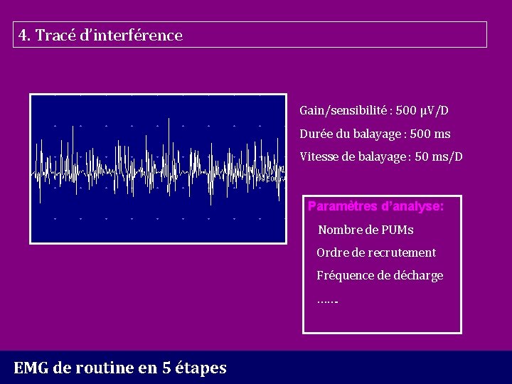 4. Tracé d’interférence Gain/sensibilité : 500 µV/D Durée du balayage : 500 ms Vitesse