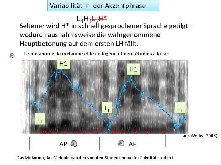 Variabilität in der Akzentphrase L 1 H 1 L 2 H* Seltener wird H*