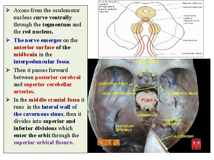 Ø Axons from the oculomotor nucleus curve ventrally through the tegmentum and the red