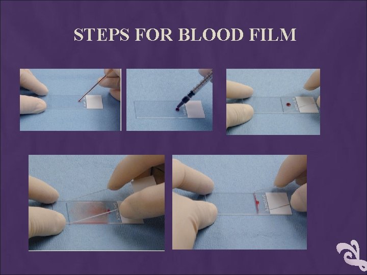 STEPS FOR BLOOD FILM 