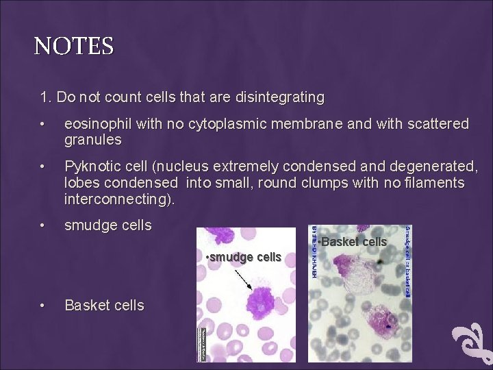 NOTES 1. Do not count cells that are disintegrating • eosinophil with no cytoplasmic