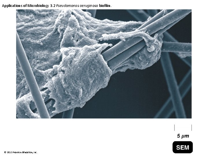 Applications of Microbiology 3. 2 Pseudomonas aeruginosa biofilm. © 2013 Pearson Education, Inc. 