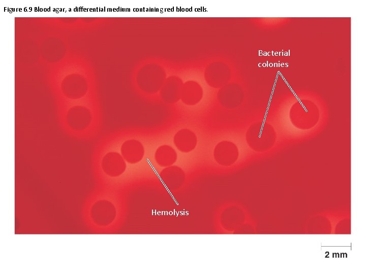 Figure 6. 9 Blood agar, a differential medium containing red blood cells. Bacterial colonies