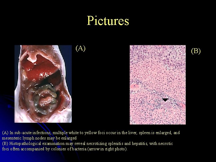 Pictures (A) In sub-acute infections, multiple white to yellow foci occur in the liver,